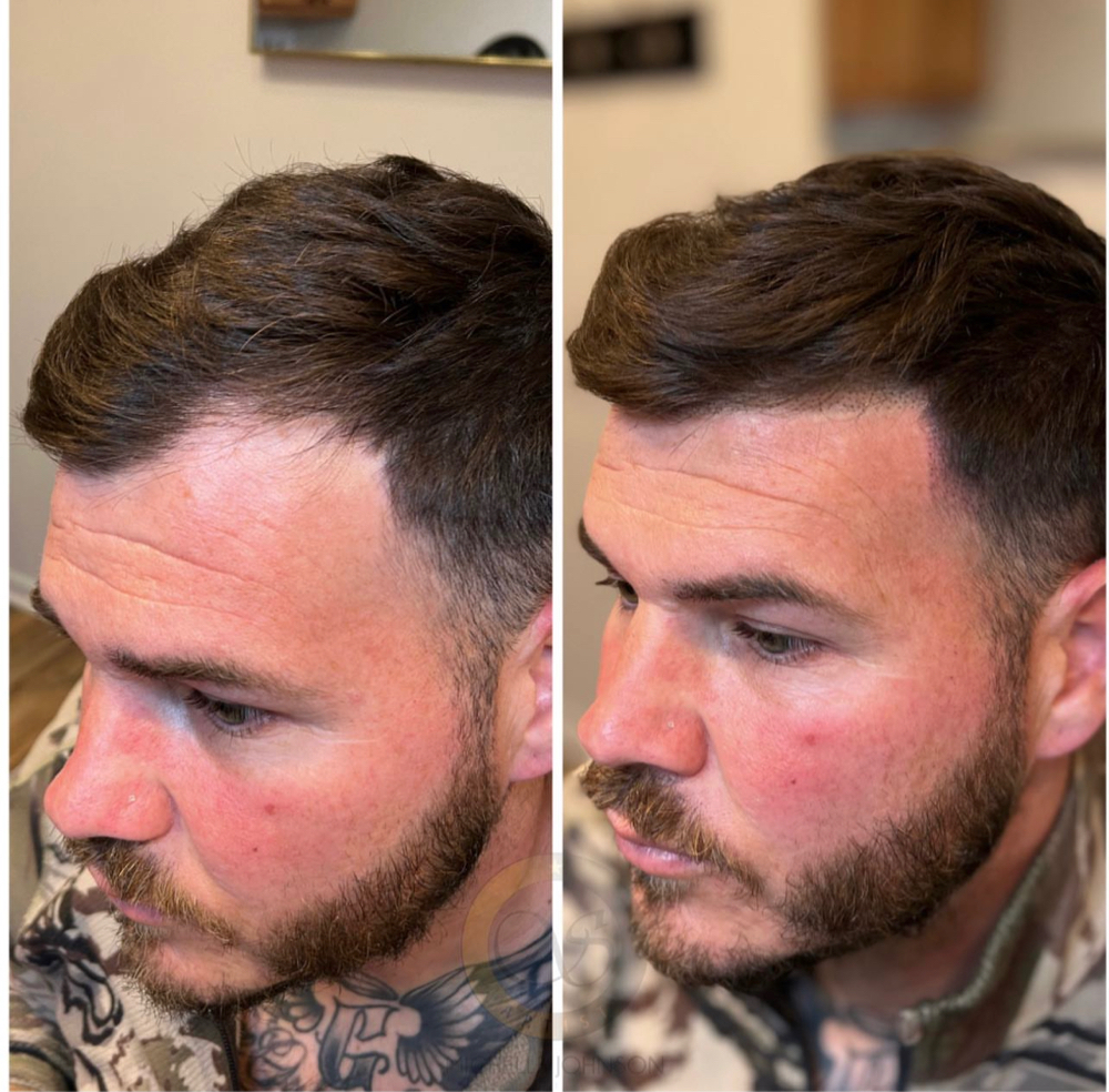 Scalp Micropigmentation at Mjartistry in Manahawkin, NJ