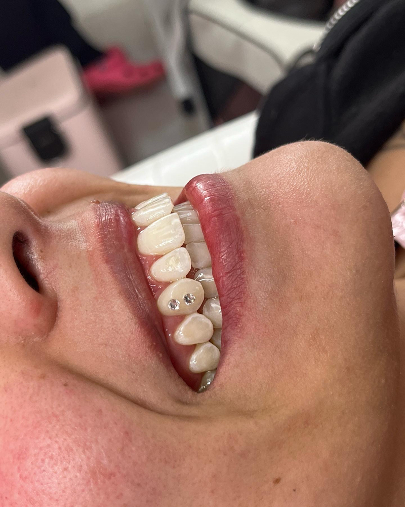 2 Tooth Gems