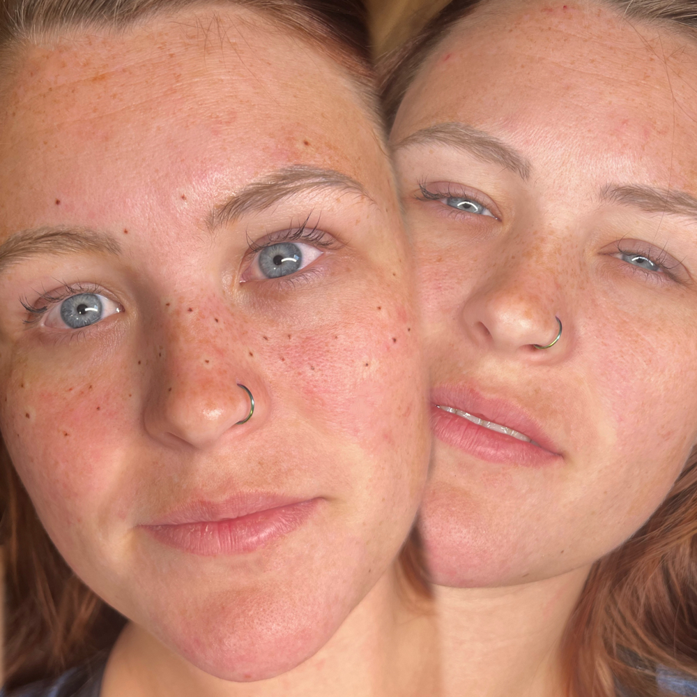 Faux freckles at Permanent Cosmetics By Alicia Polk in Bentonville, AR
