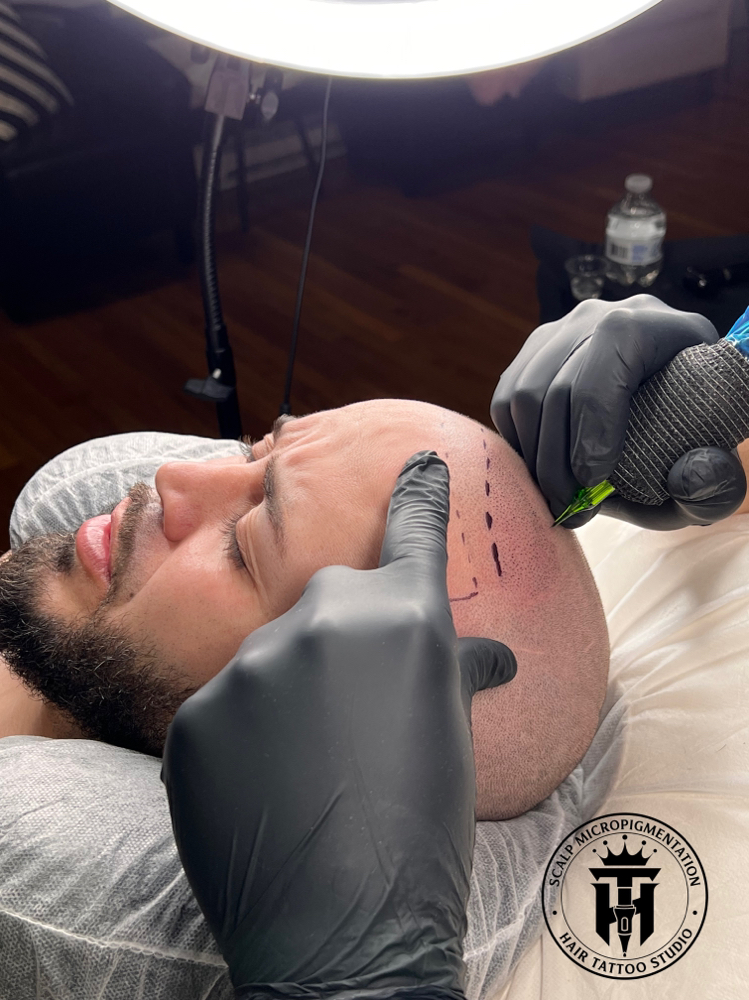 Scalp Micropigmentation at SARA OSPINA STUDIO in Revere, MA