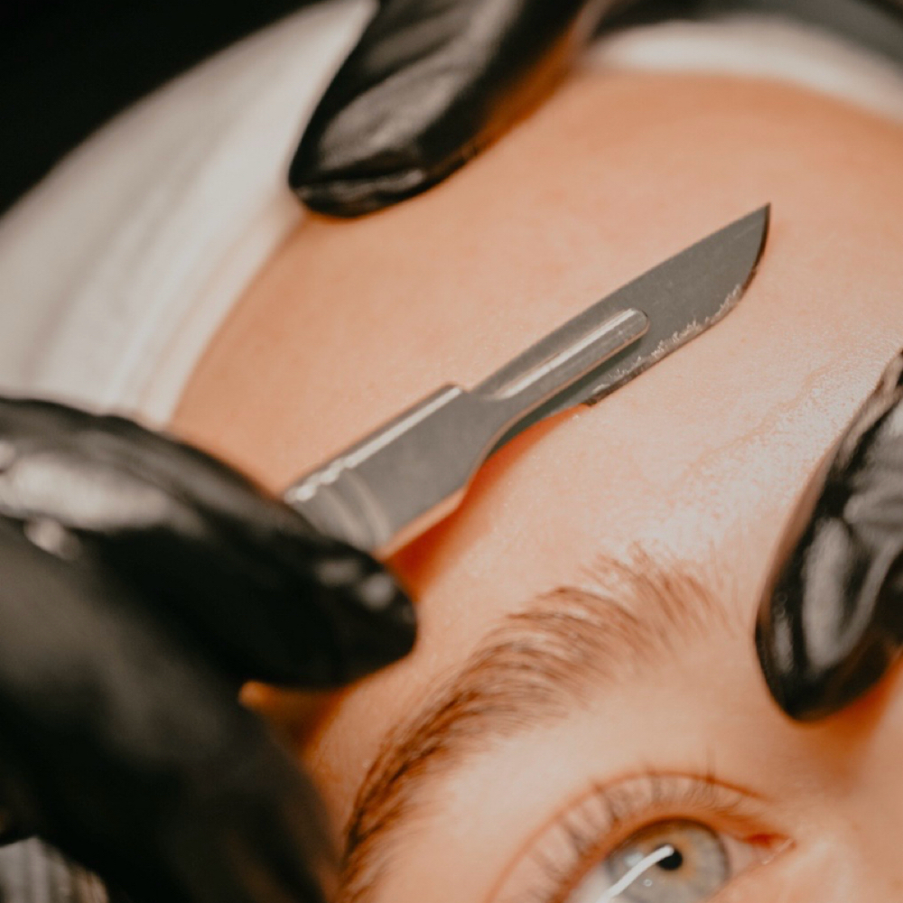 Dermaplanning Treatment at Kelly C Aesthetics in Lutz, FL