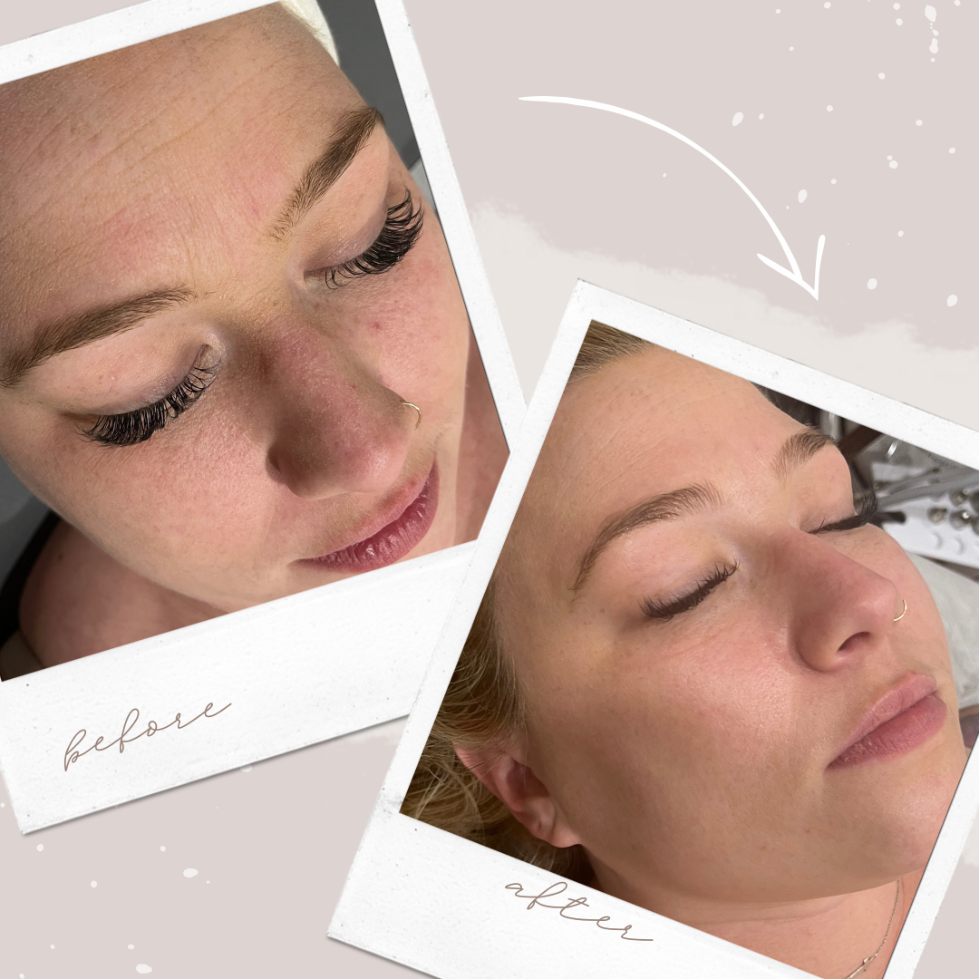 (SPRINGFIELD) Custom Glow Facial