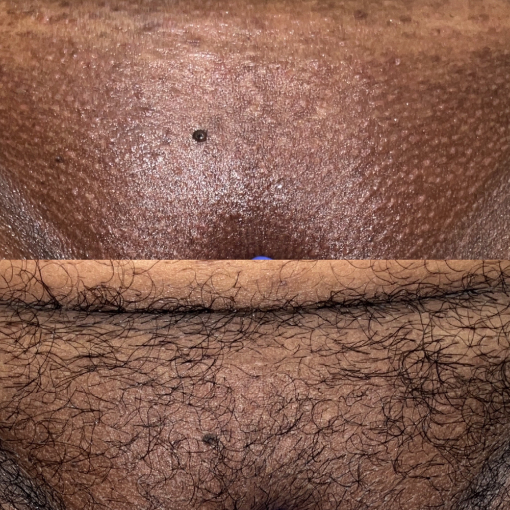 Brazilian Wax