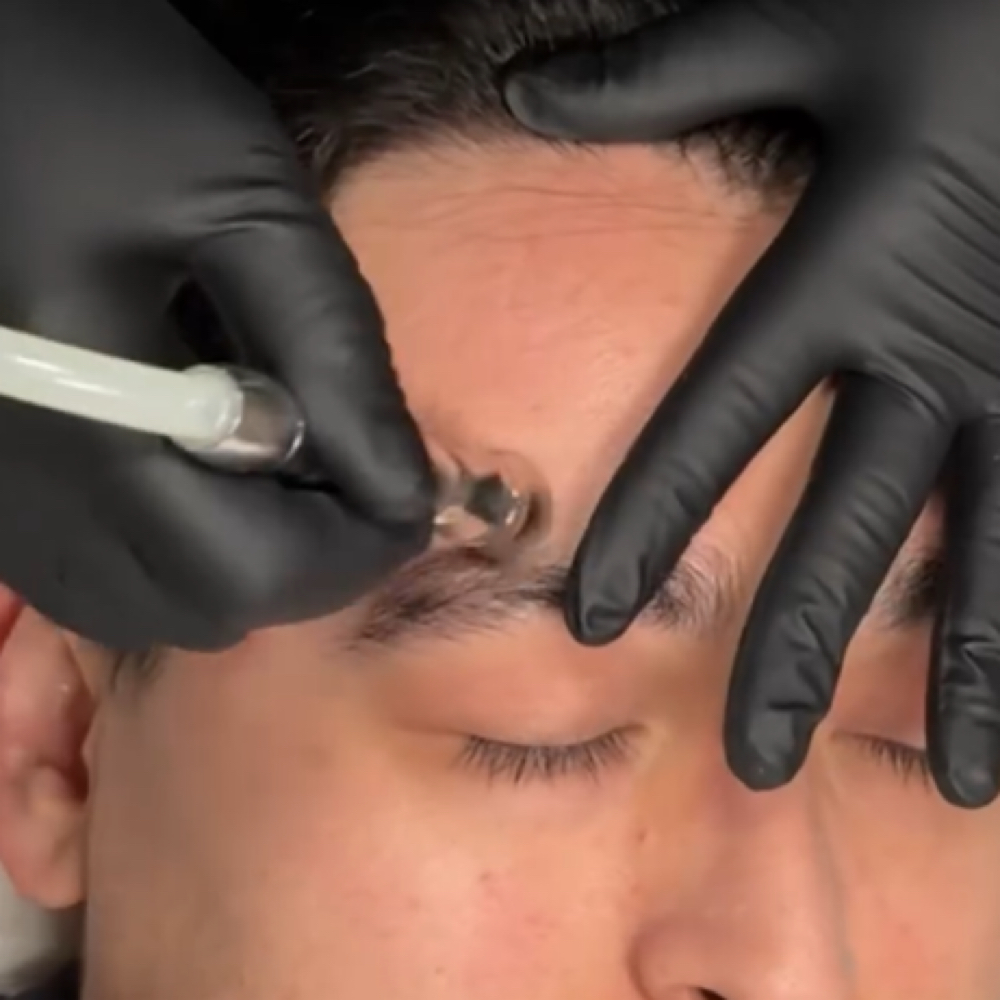 Microdermabrasion Facial at Eres Bella Day Spa in Bell, CA