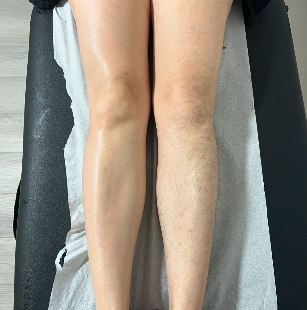 Full Leg Wax