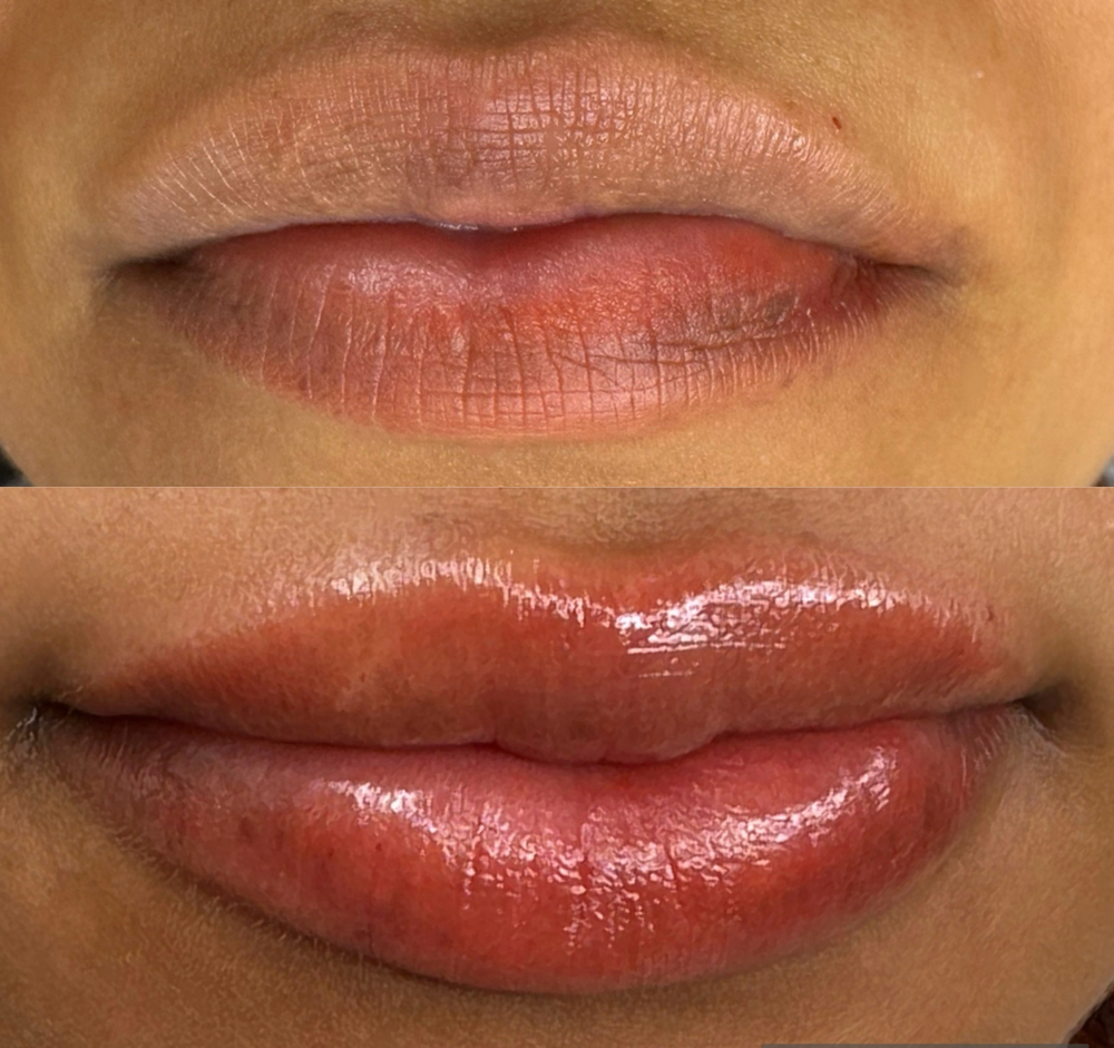 Lip Neutralization