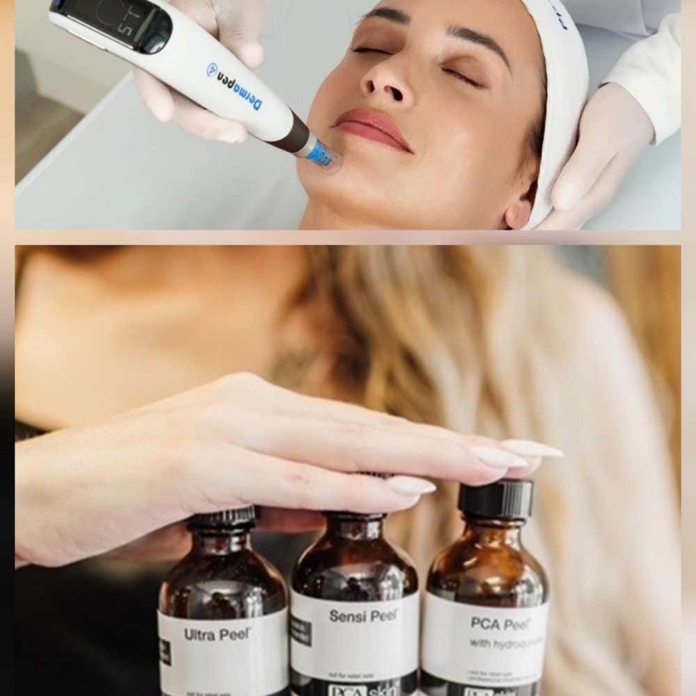 Optimal Facial Resurfacing Package at CARE Esthetics Orange Park in Orange Park, FL