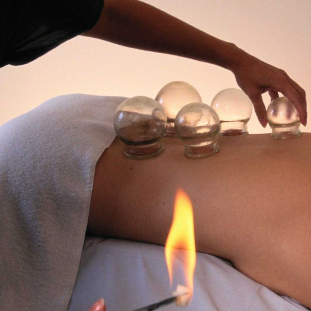 Fire Cupping at Divine Skin Studio in El Cajon, CA