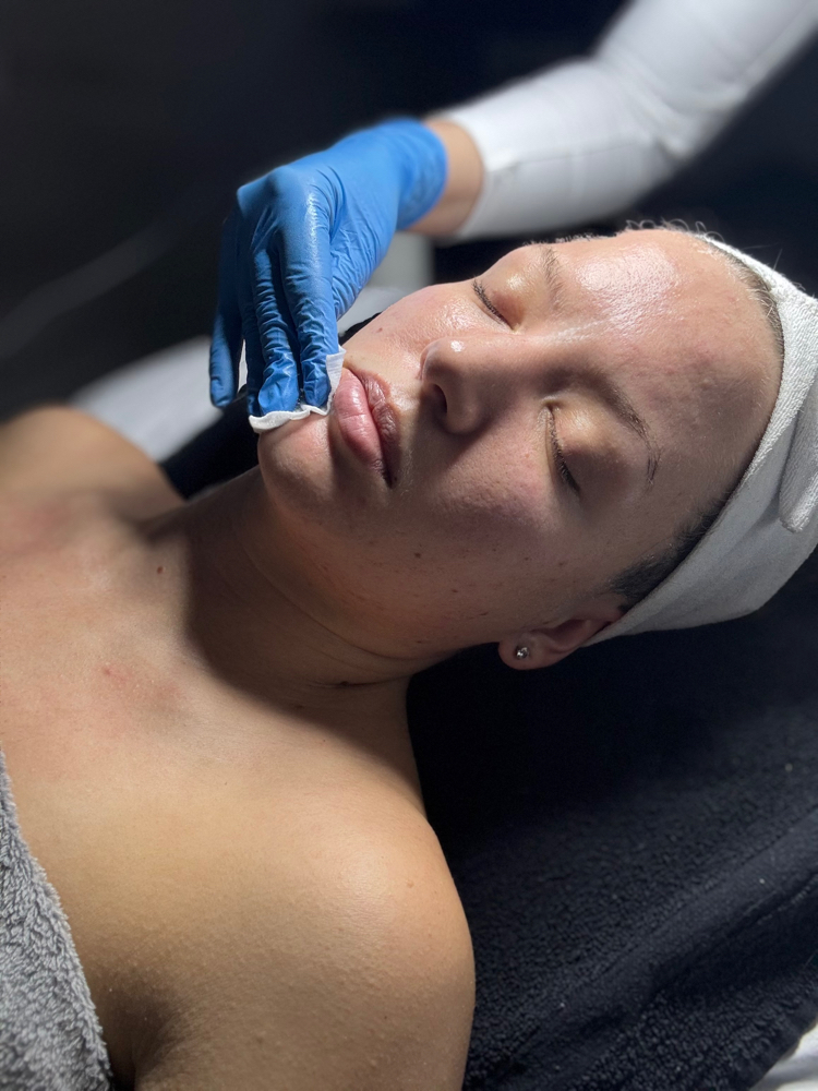 Virtual Skin Consultation