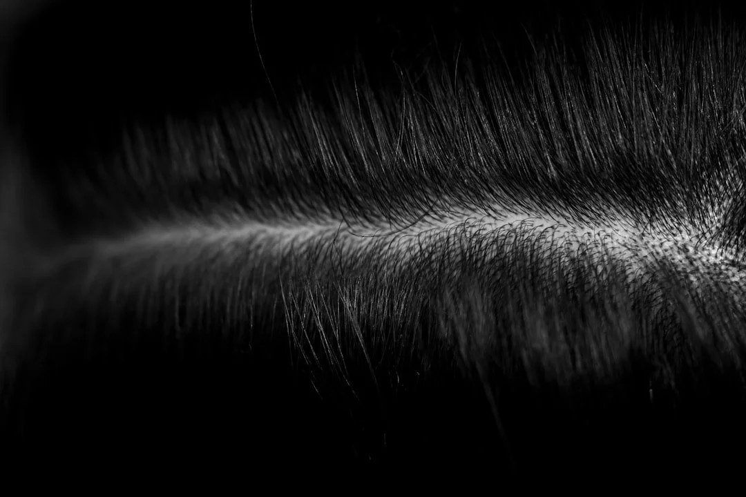 Scalp Analysis
