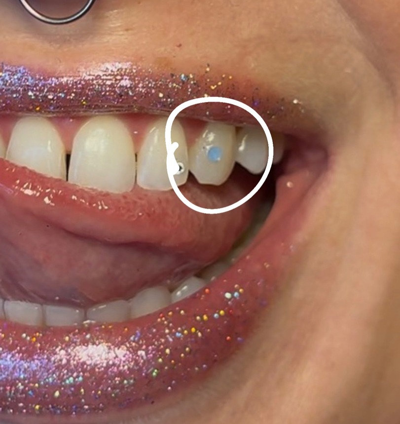 Round Opal Gem Application