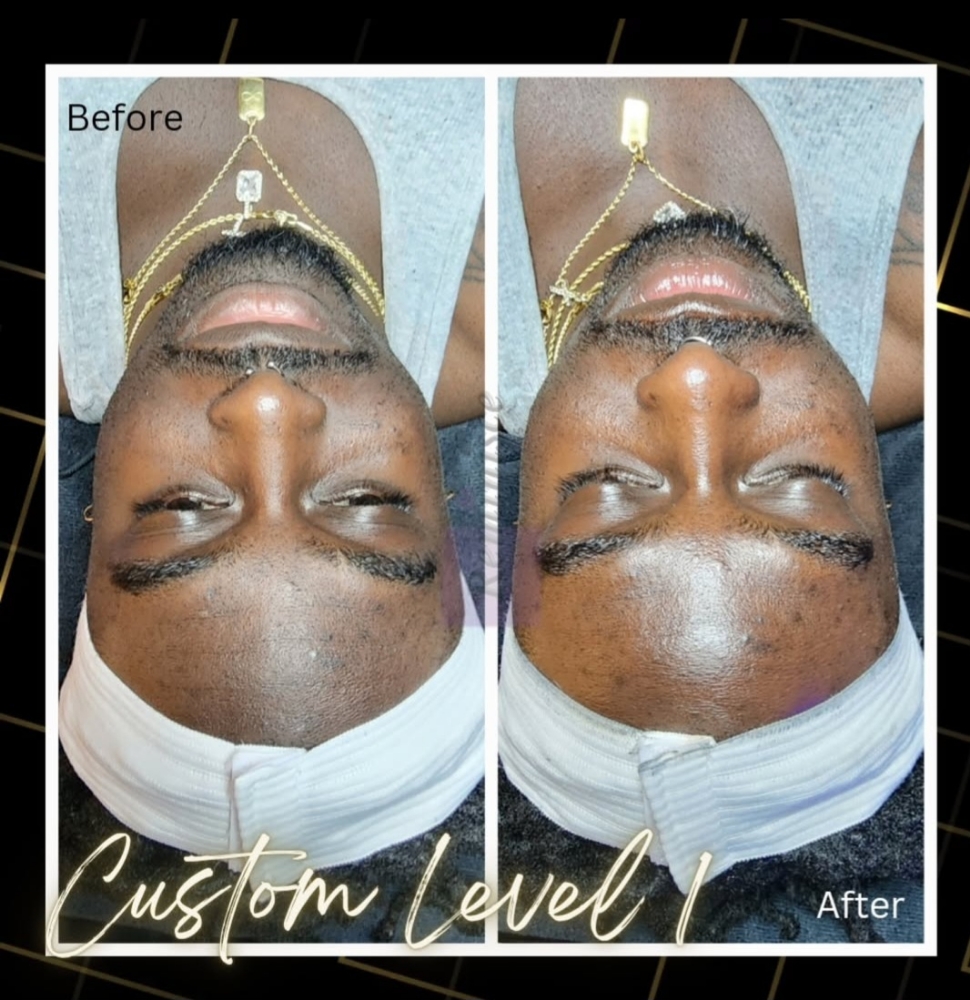 Customized Level 1