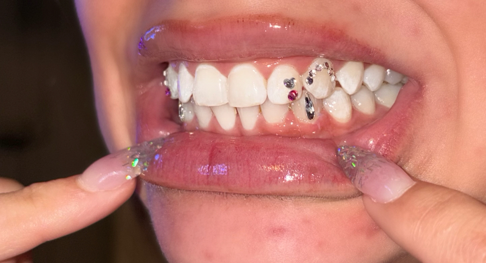 1 Week Free Replacement