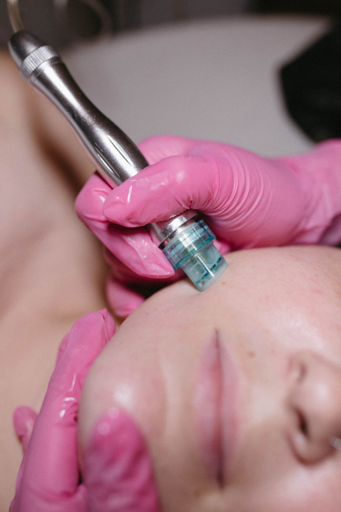 Hydradermembrasion