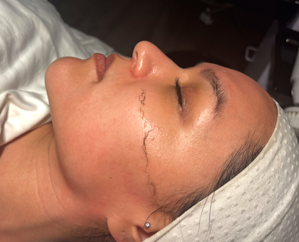 Dermaplane facial