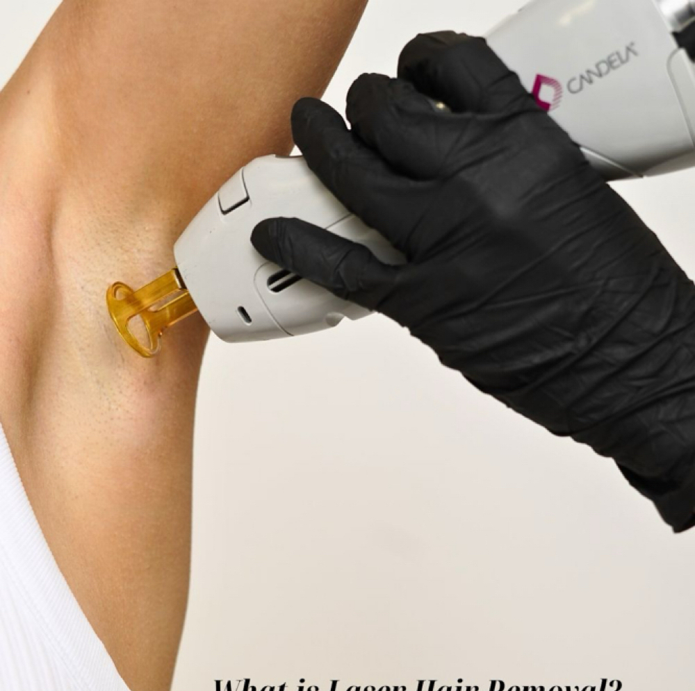 Laser hair removal at Beuxtique in Sugar Land, TX