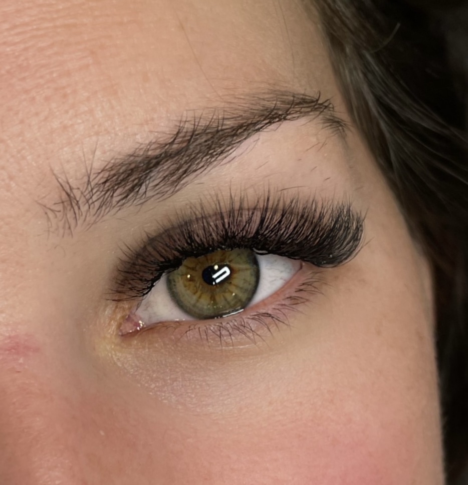 Hyrbid Fill (2-3 Weeks)