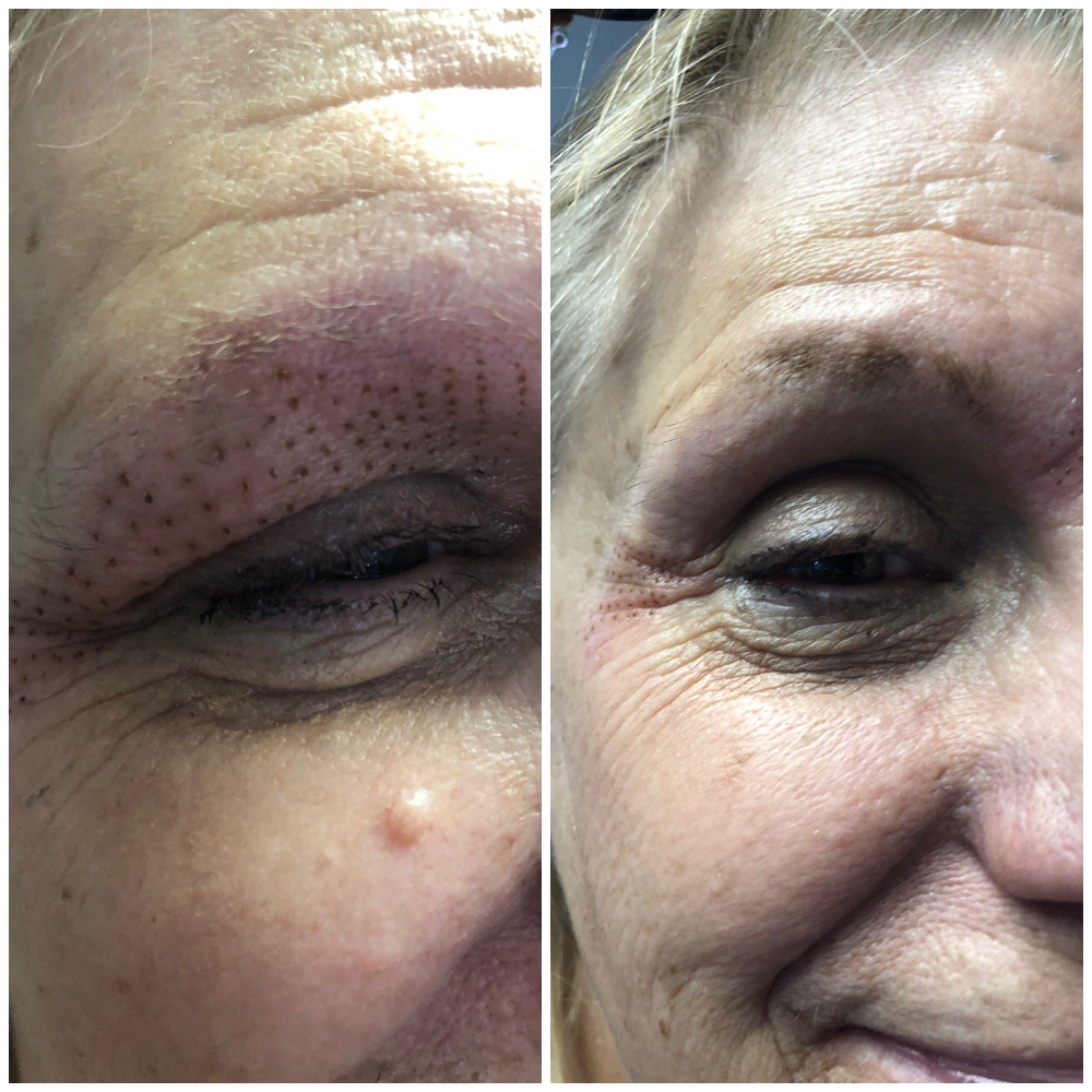 Small Fibroblast 1 Spot