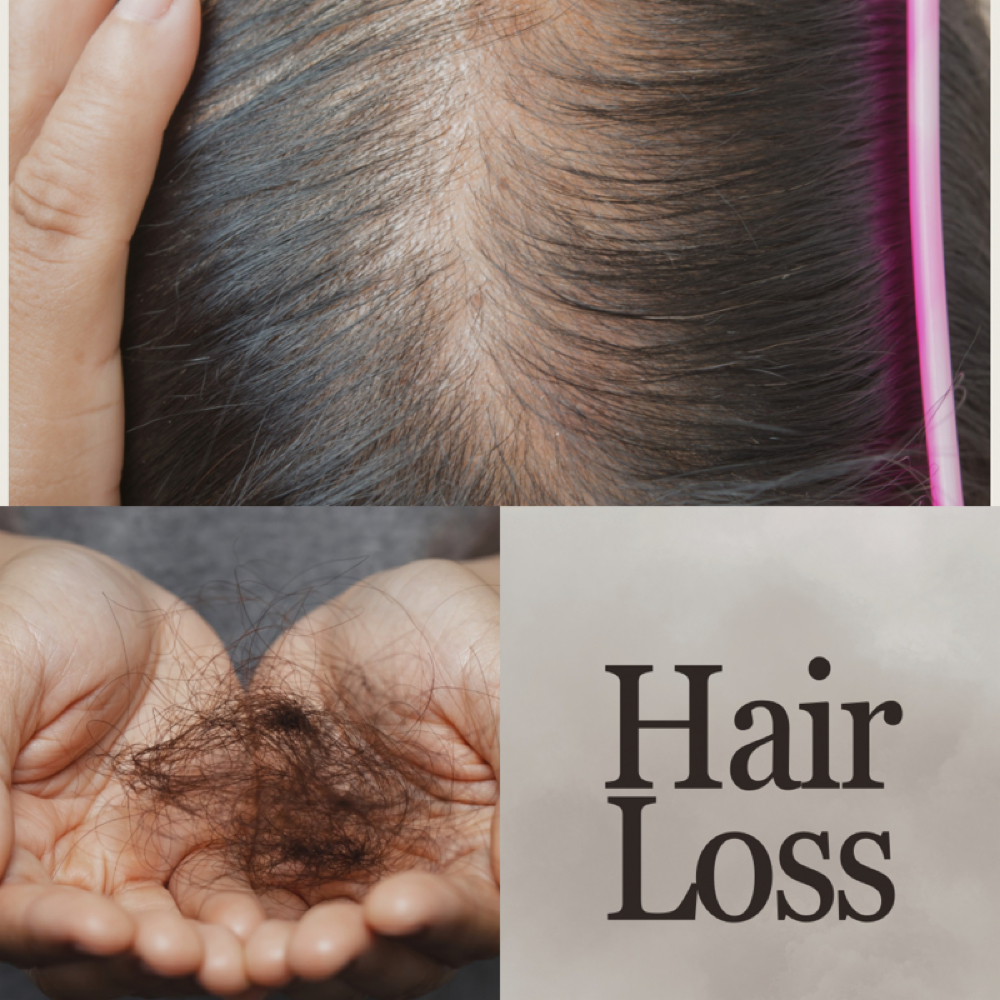 Hair Loss Consultation at Salon Roque & Scalp Spa in 35226