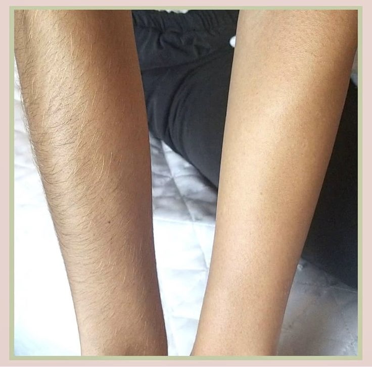 Full Arm Wax