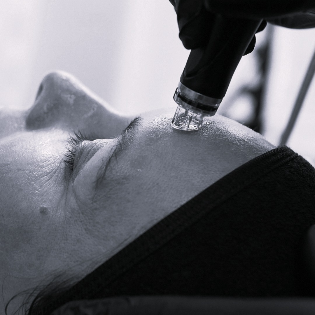 THE SANTA BARBARA HYDRAFACIAL at Wild Lotus Skincare in Santa Barbara, CA