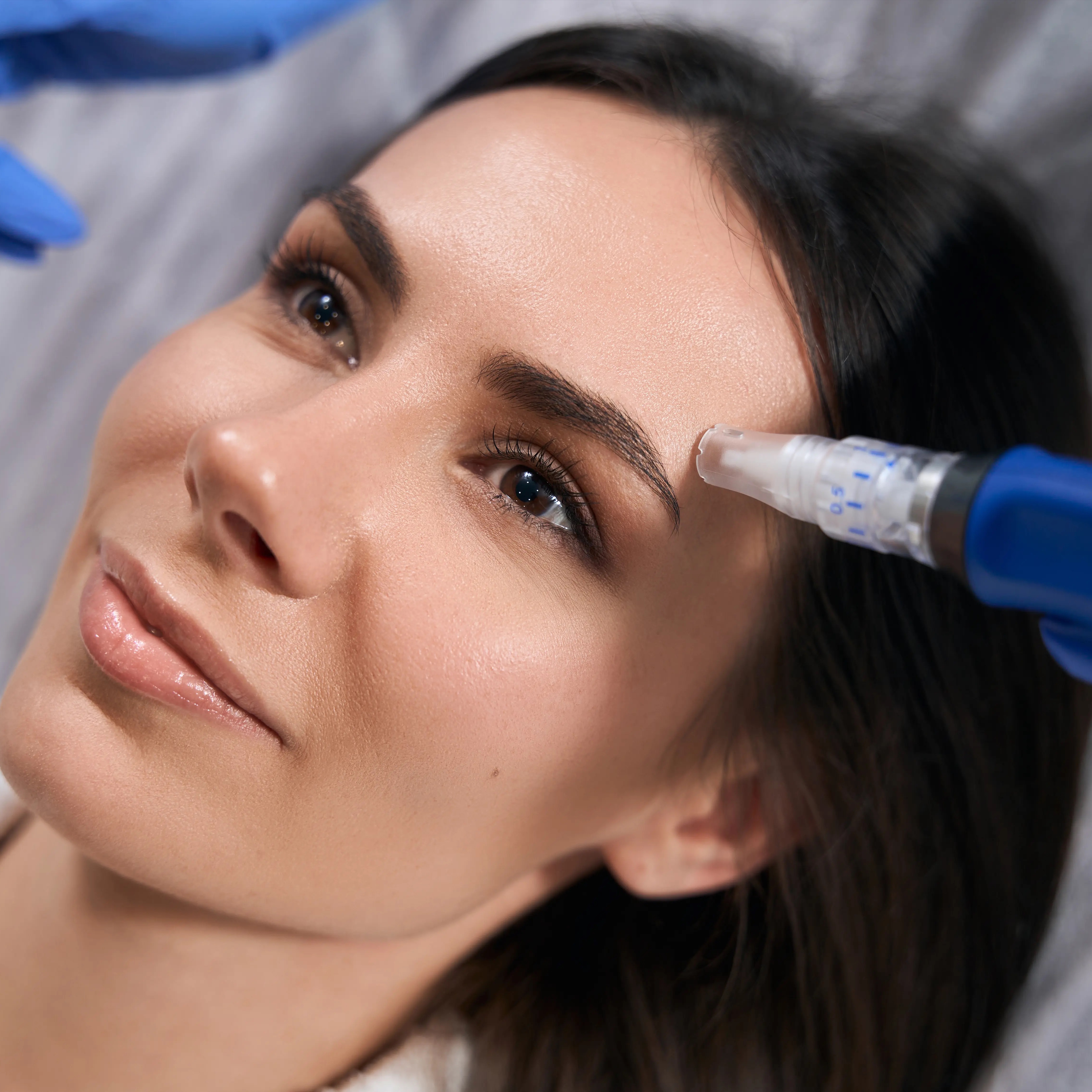 RP Microneedling Face+Neck+Chest at Katie Rose Aesthetics in Coeur D Alene, ID