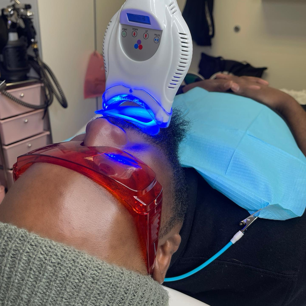Cosmetic Teeth Whitening (60 Mins)