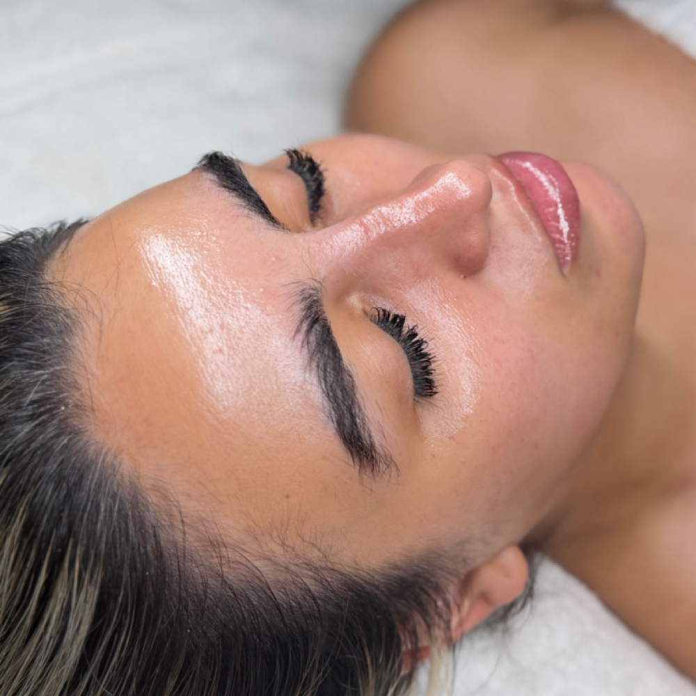 The Perfect Peel at Skinncareave in San Bernardino, CA