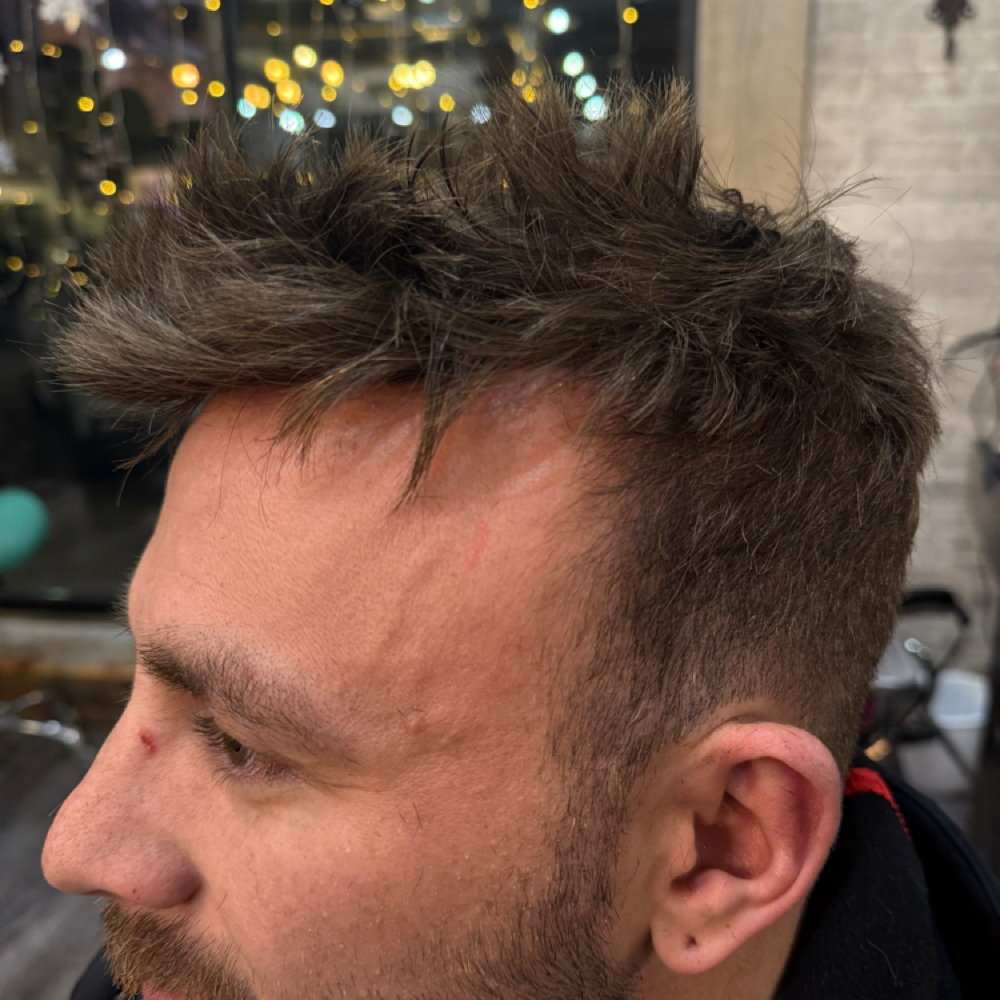 Hair System (Toupee)