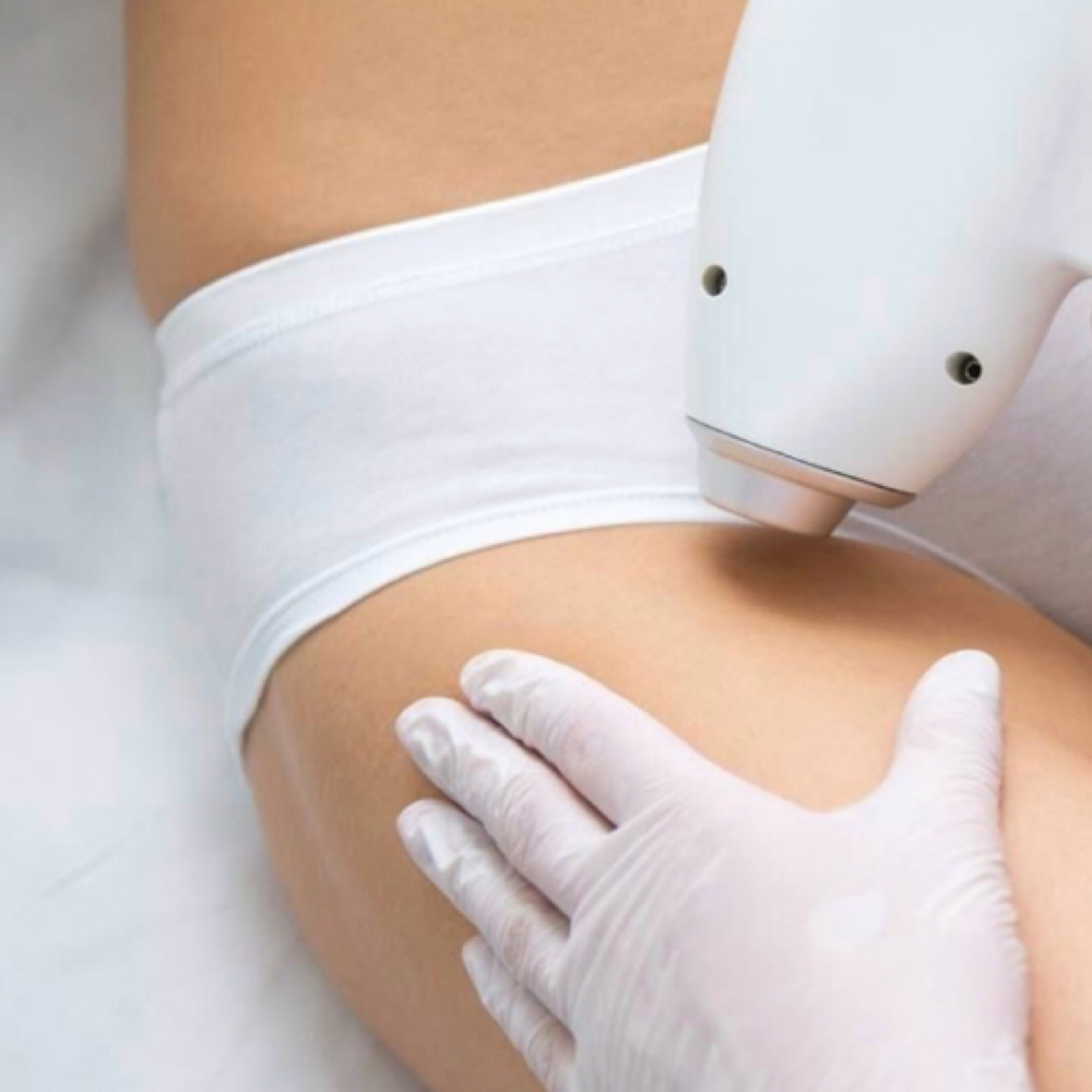 LHR Medium Area at A&A Beauty Bliss in Cape Coral, FL