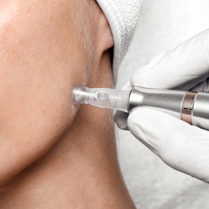 Collagen Inducing Therapy at StudioJQ in Miami, FL