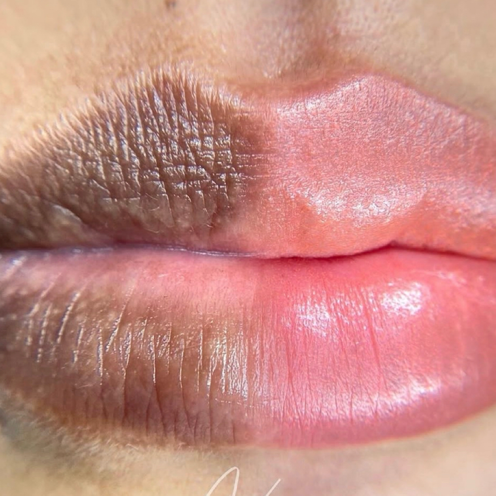 Dark Lip Neutralization at Beauty and Brows in Queens, NY