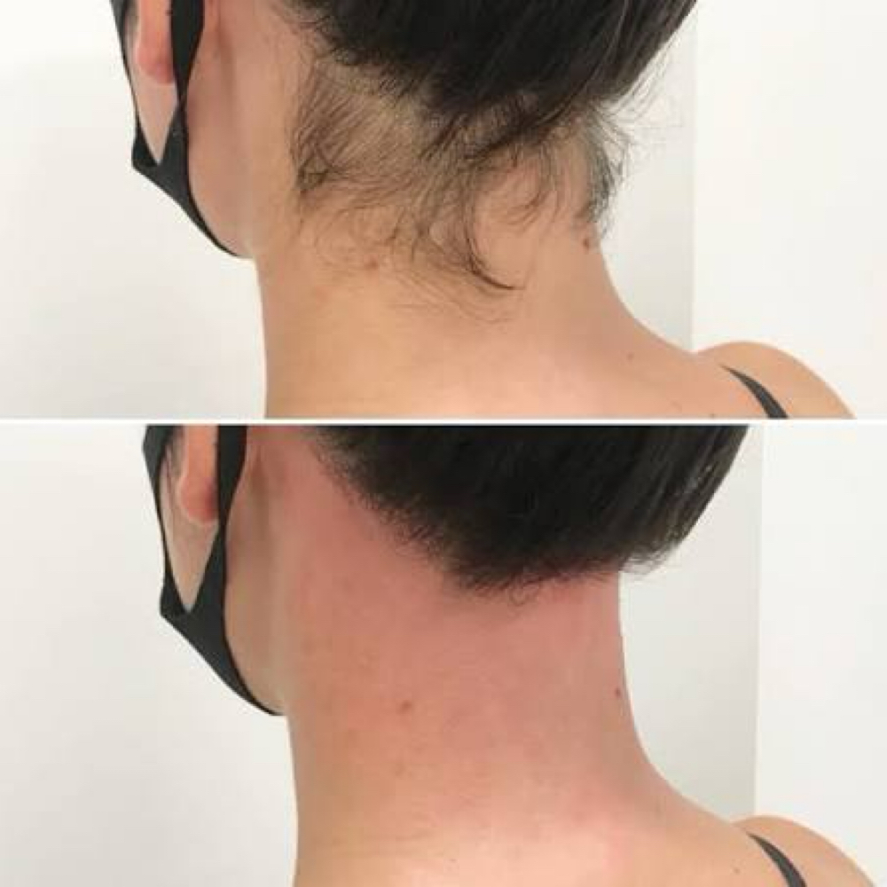 Neck at Luscious Beauty “The Brazilian Specialist” in Clovis, NM