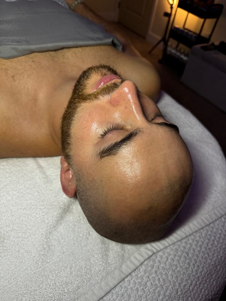 Custom Chemical Peel Facial
