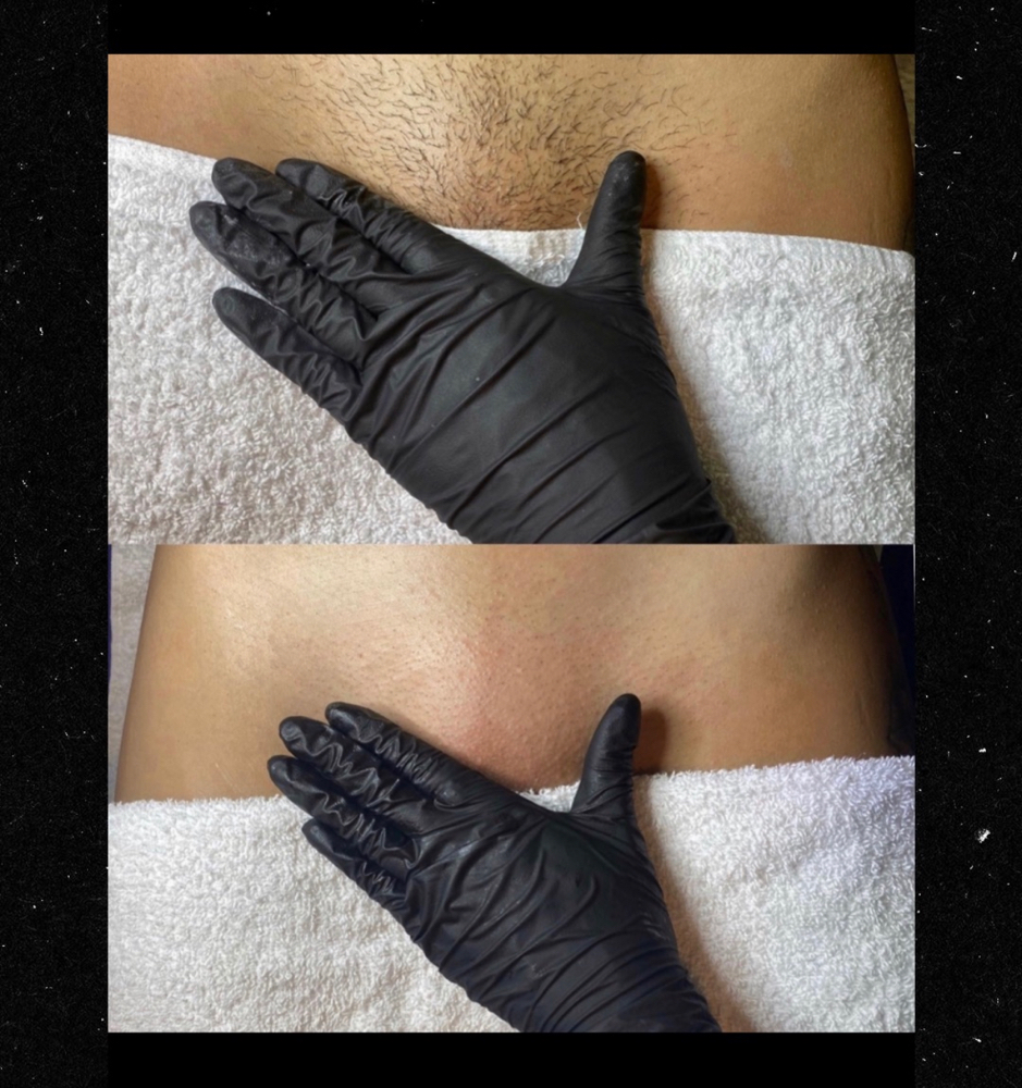 Brazilian Wax