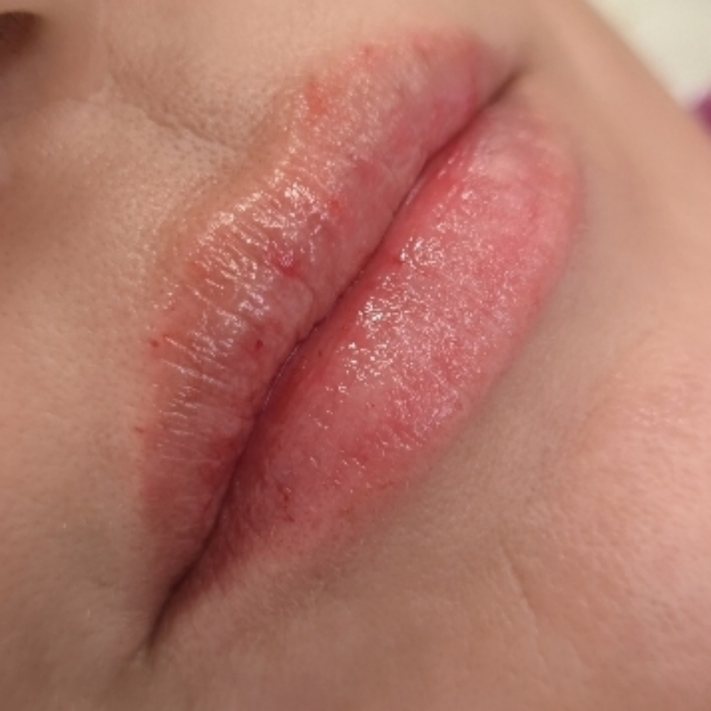 Lipfiller at BeautyPlanetbyBarbie in PRINCETON, NJ