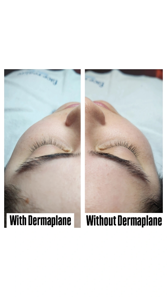 Dermaplane MINI FACIAL