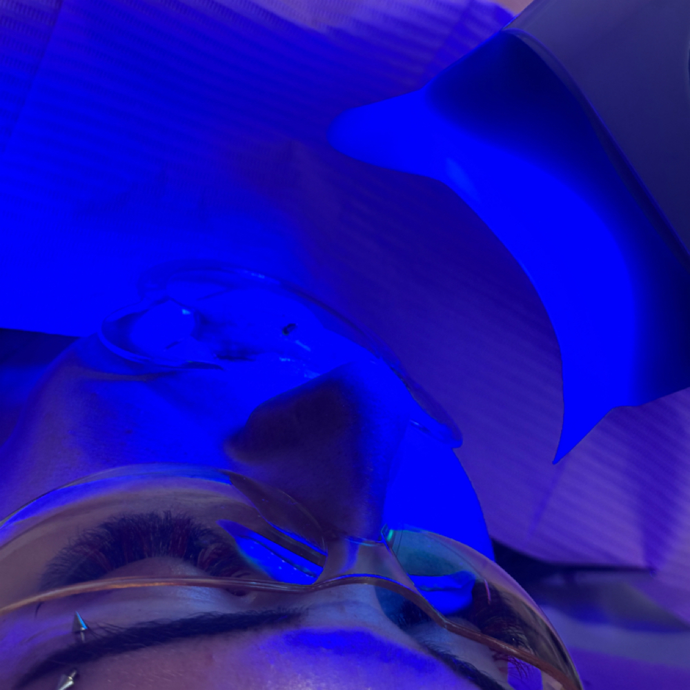 Teeth Whitening at Vega Lash Co LLC in Milton, WI