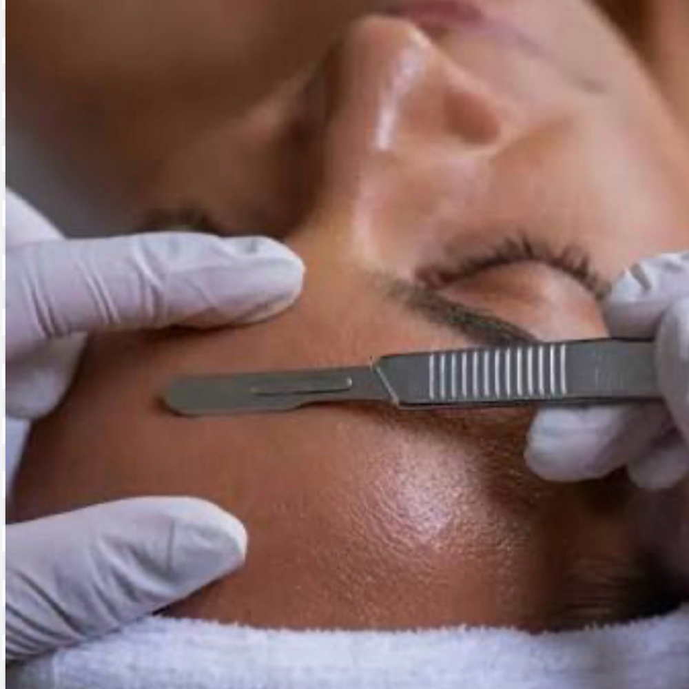 The Dermaplane at Bella Vero Studio, LLC in Hamburg, NY