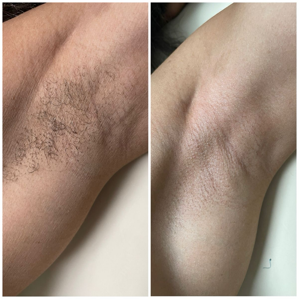 Underarm Waxing