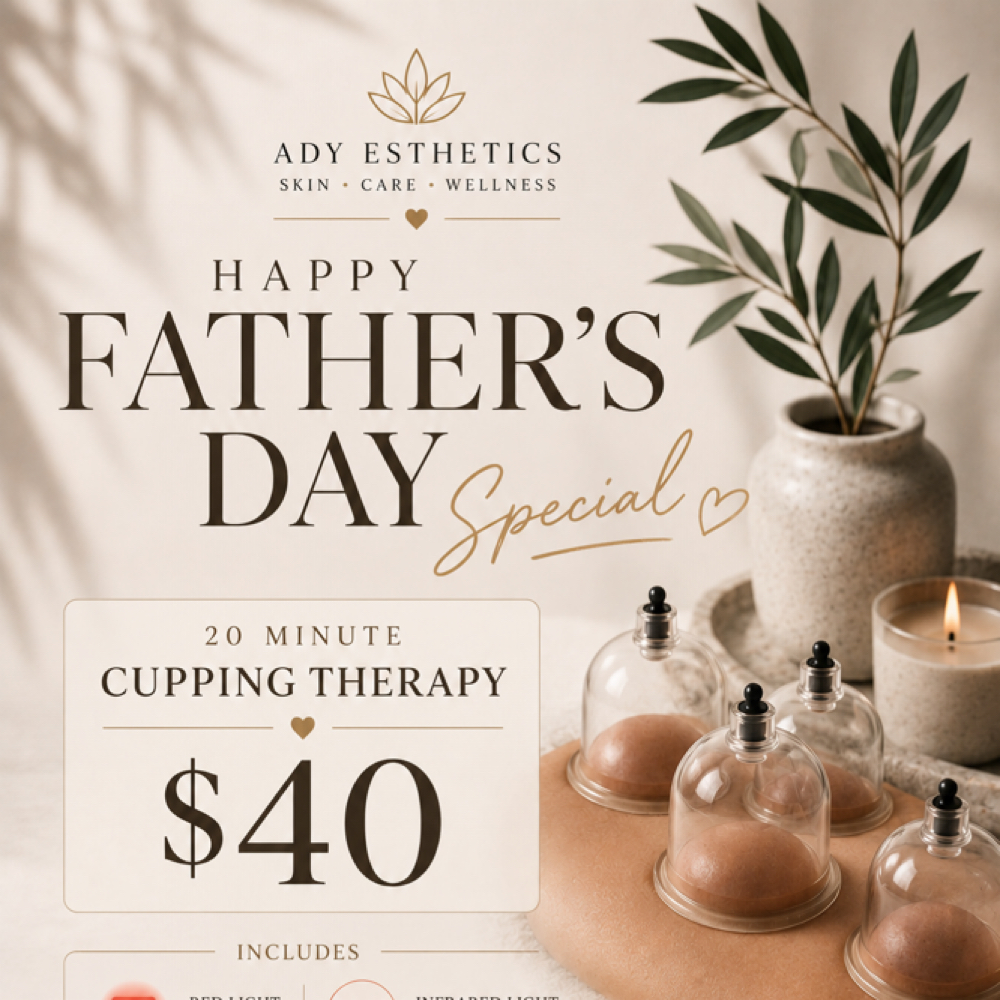 Fathers Day Cupping SPECIAL! at Ady Esthetics in San Diego, CA