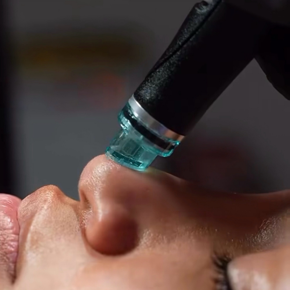 The Hydrafacial Express at Skin Deep By Ash in Roseville, CA