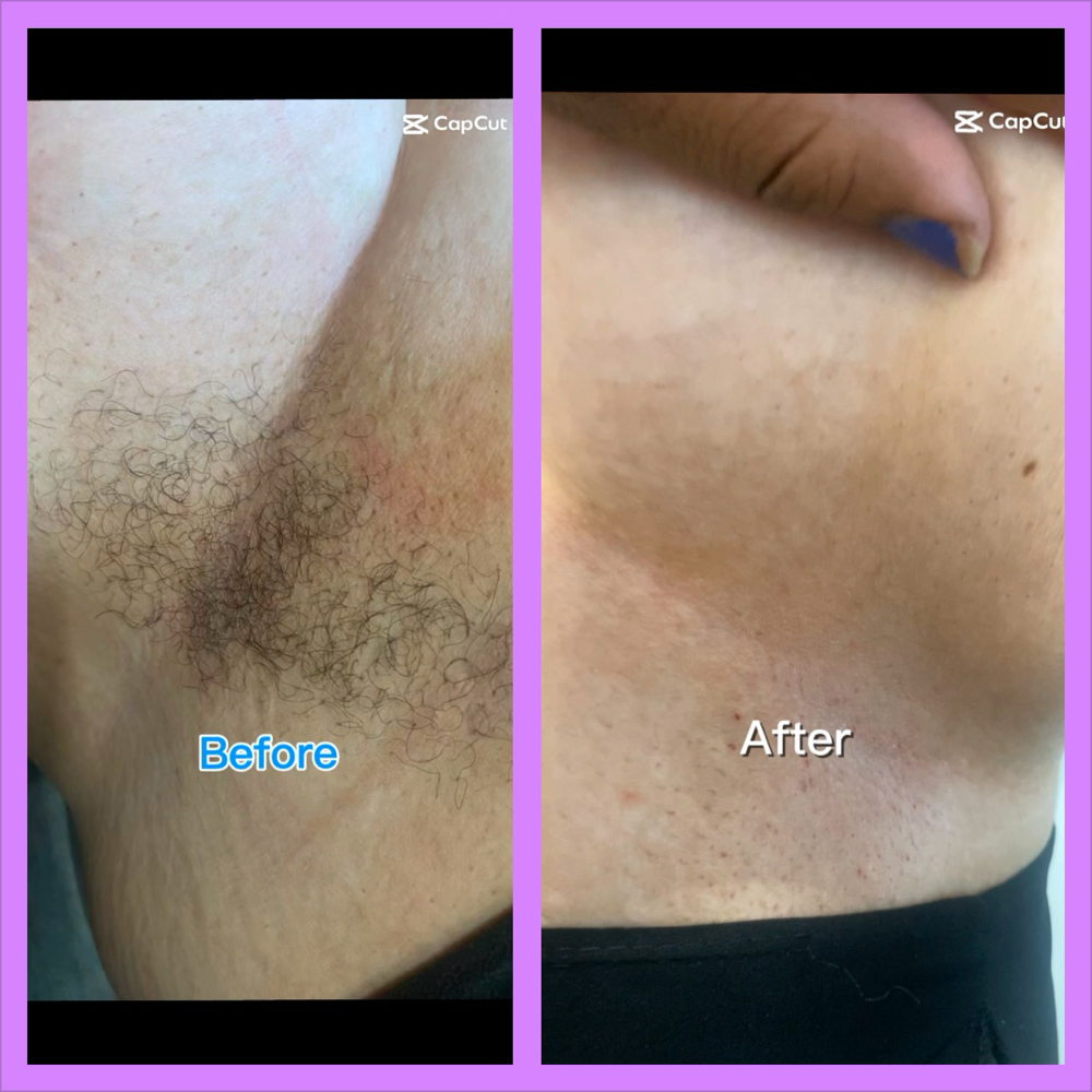 Underarm Wax Service