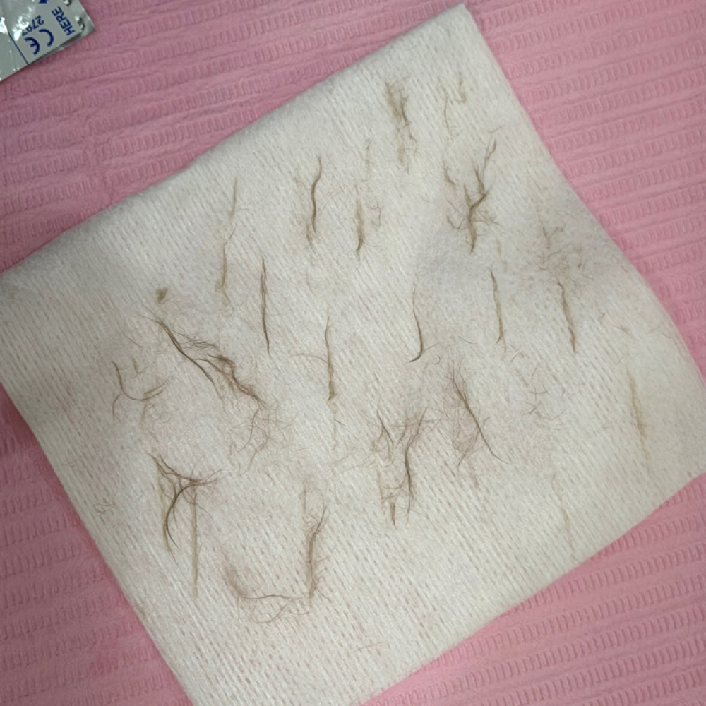 Dermaplane Facials at PerfectionByPres in Tooele, UT