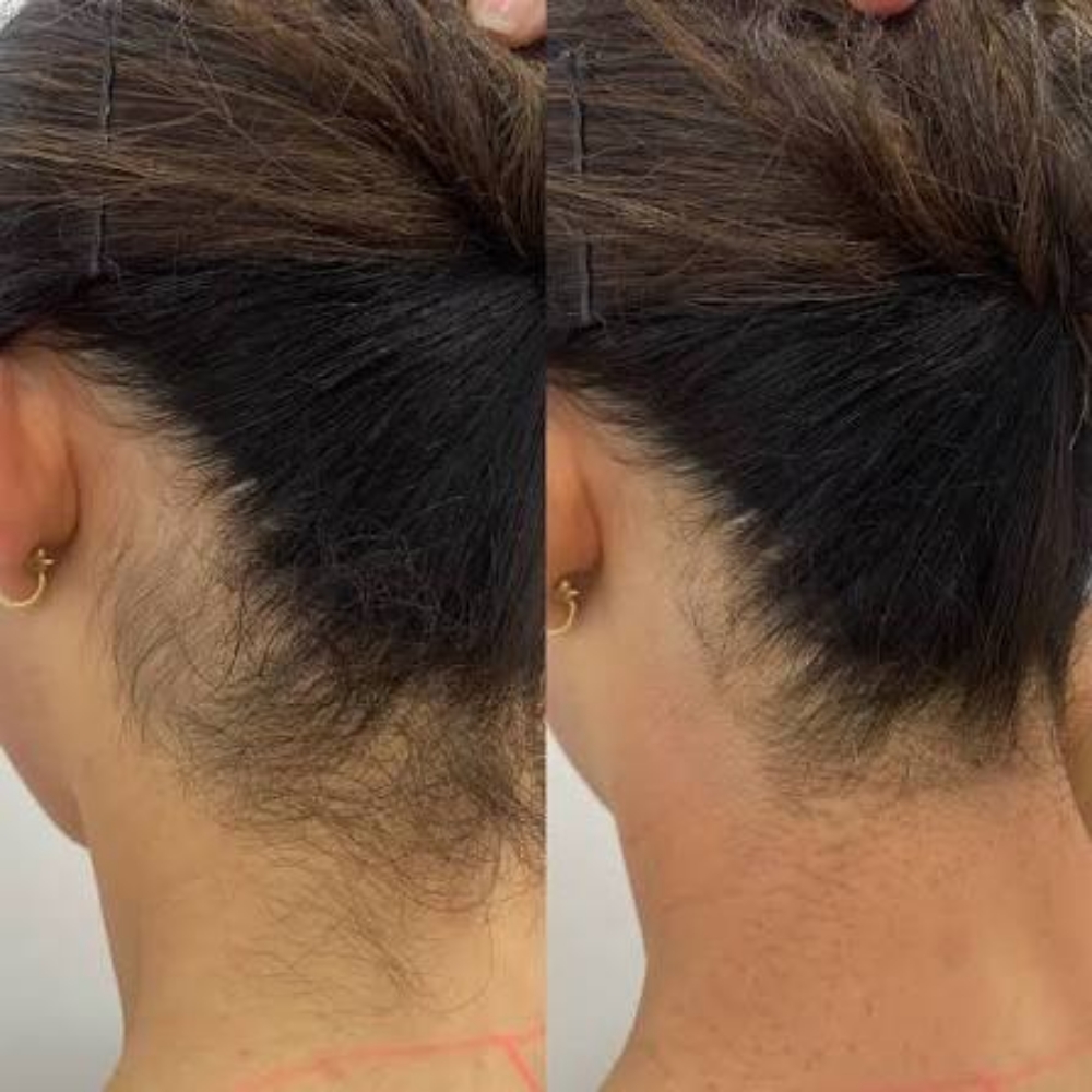 Baby Hair On Back Of Neck at 121 Studio in Marshall, IL