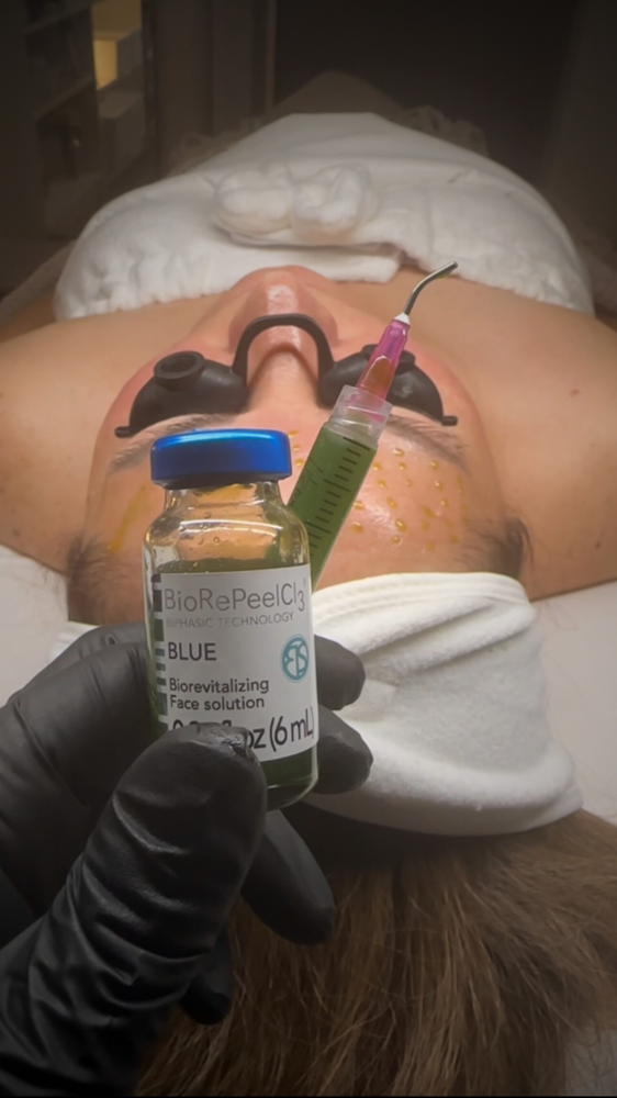 Séance Facial (BioRePeel+HydroDerm)