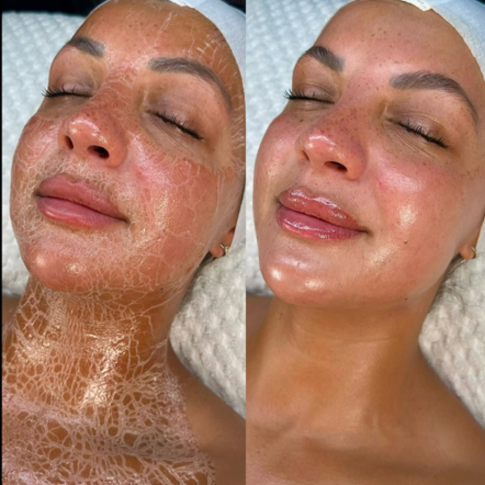 Luxe Lift Anti Aging Facial at Haylee Jade Esthetics LLC in Ellijay, GA