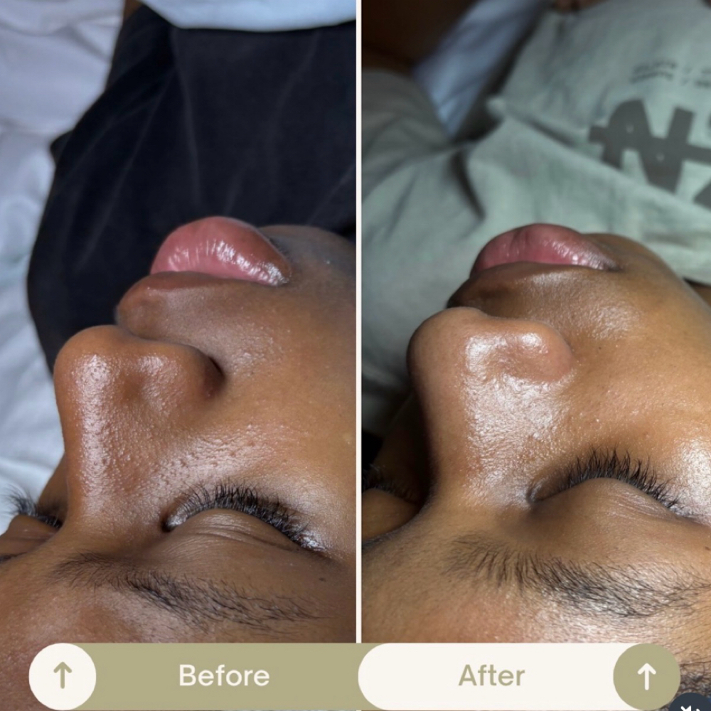 Teen Facial + Education at The Skinfidence Collective in St. Clair Shores, MI