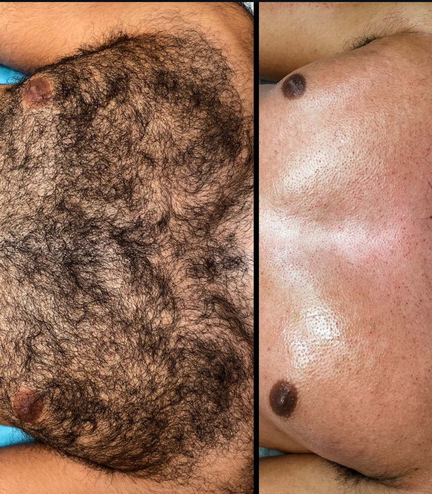 Chest Wax at Dymond Rare Beauty in Whiteville, NC