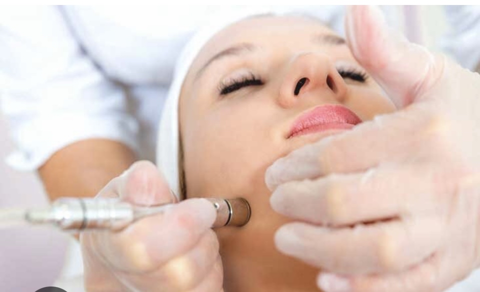 Microdermabrasion